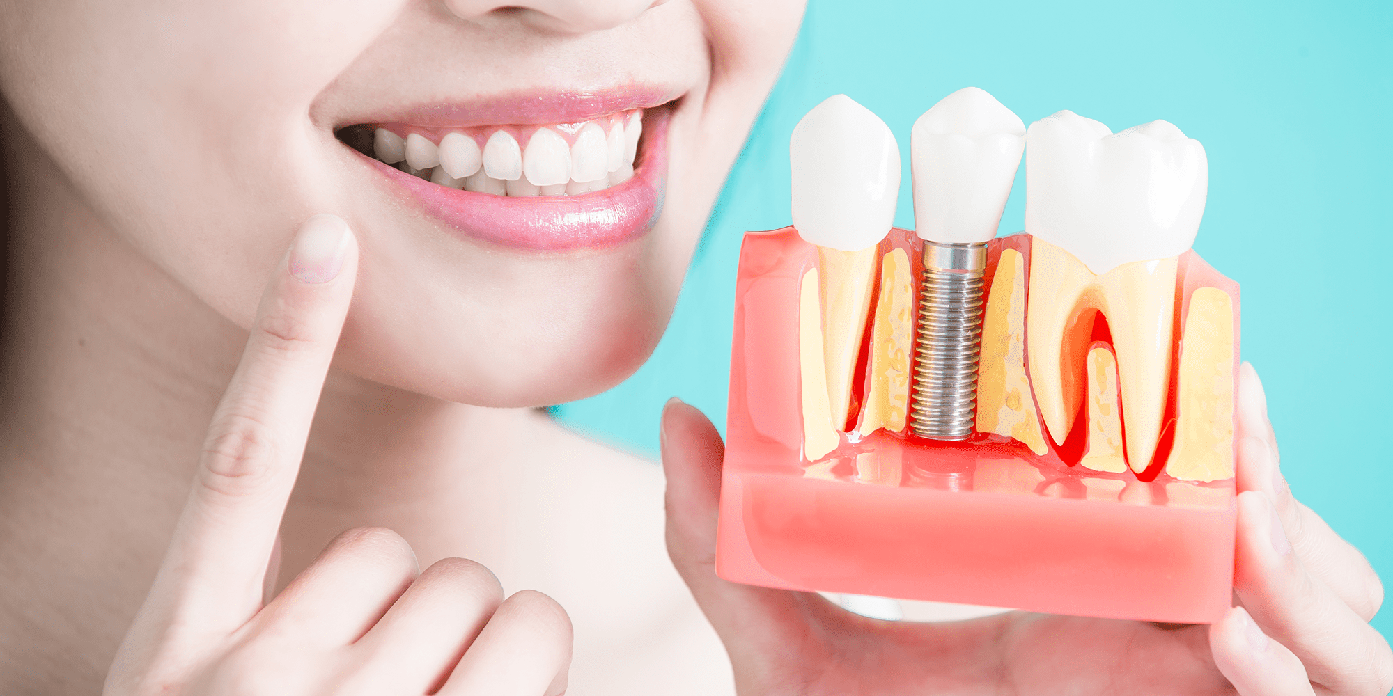 Dental Implants in Burke, VA Best Dentist in Burke, VA MM Dentistry Dentist in Burke Virginia Dr. Minh Ma DDS
